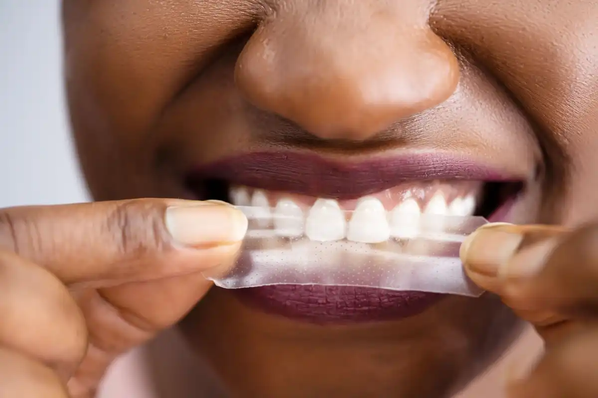 Are Residue Free Teeth Whitening Strips Safe For Health?